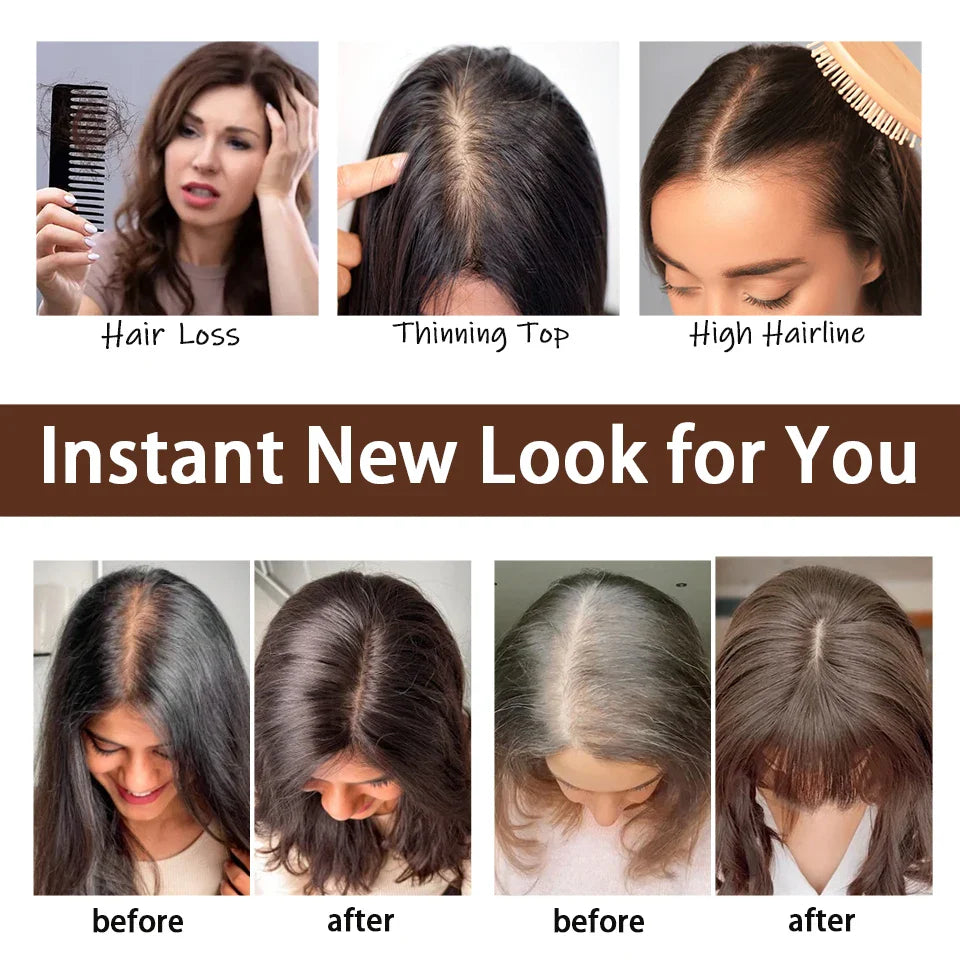 Dazzeal 100% Real Human Hair Toppers for Women